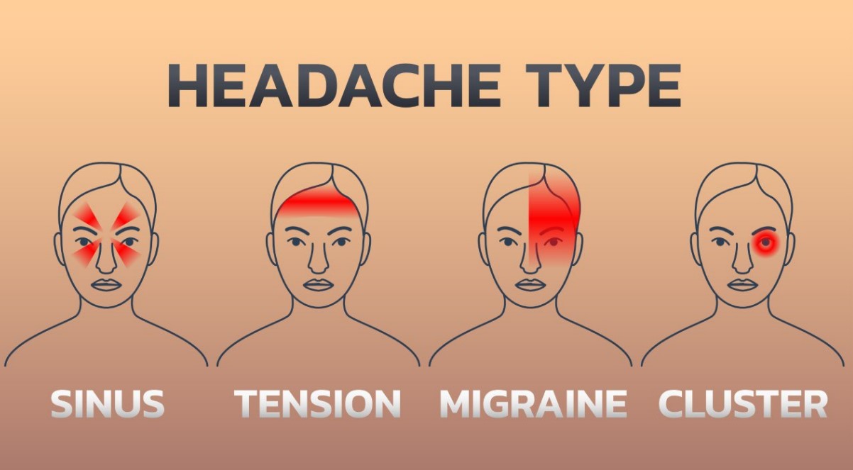 types of headache