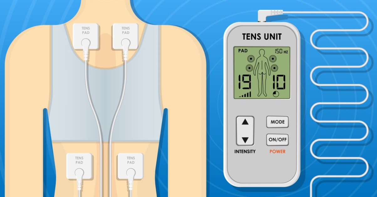 electrical nerve stimulation