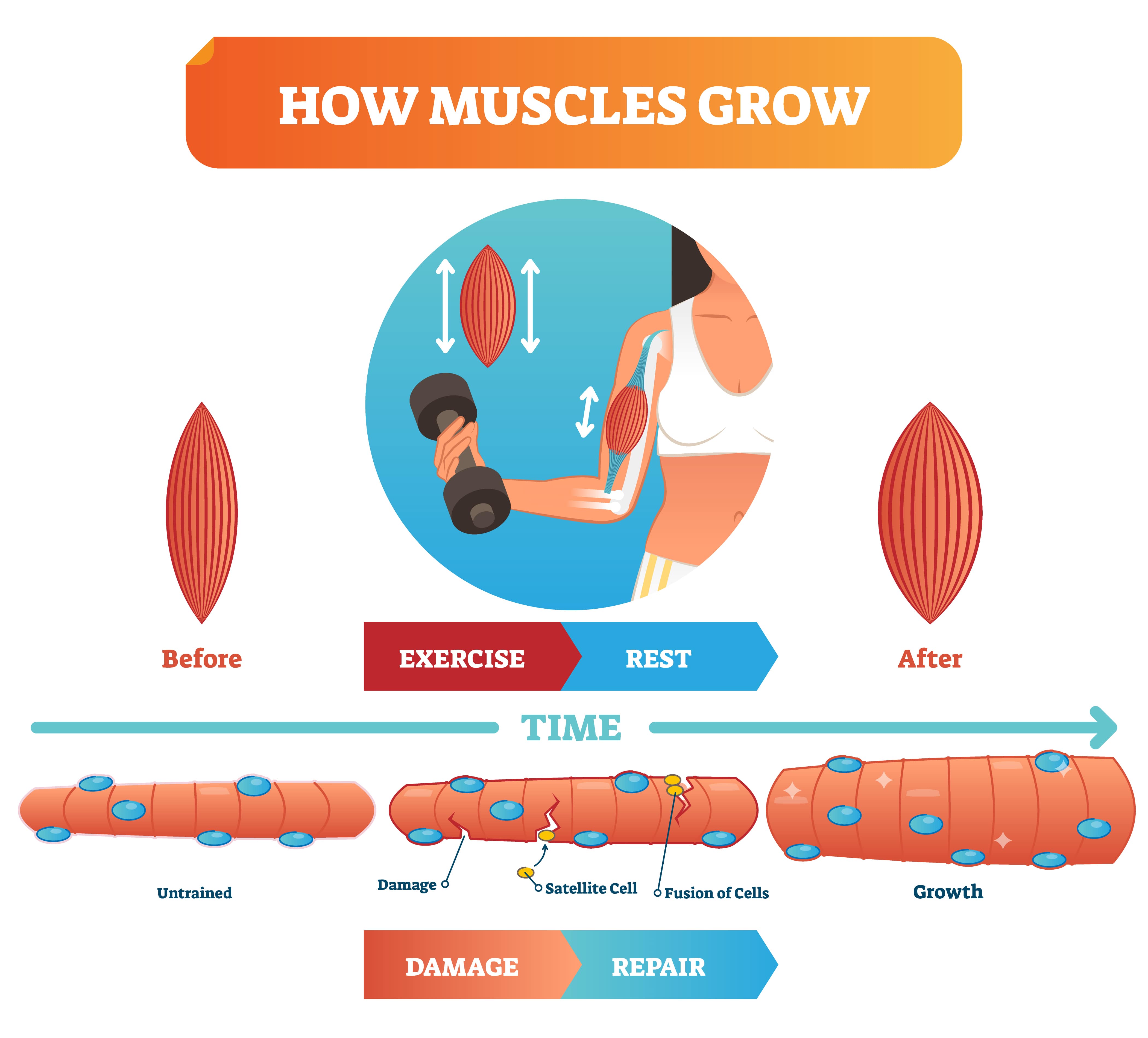 muscular pain